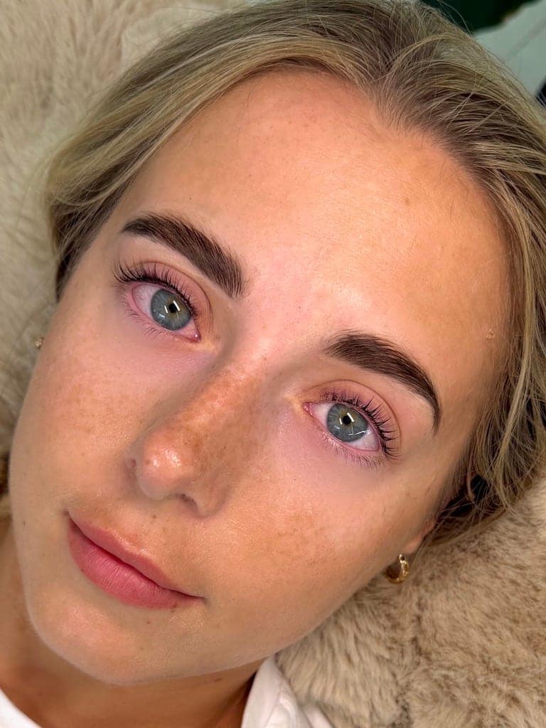After, Brow Lamination
