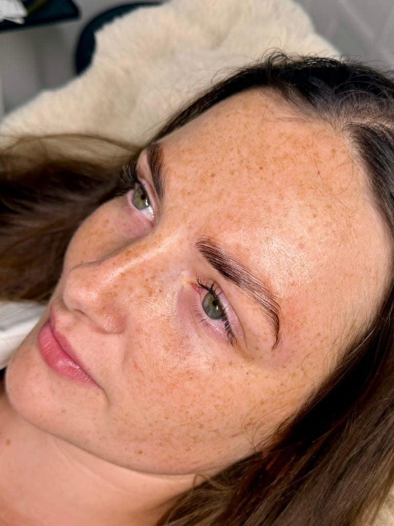 After, Brow Lamination