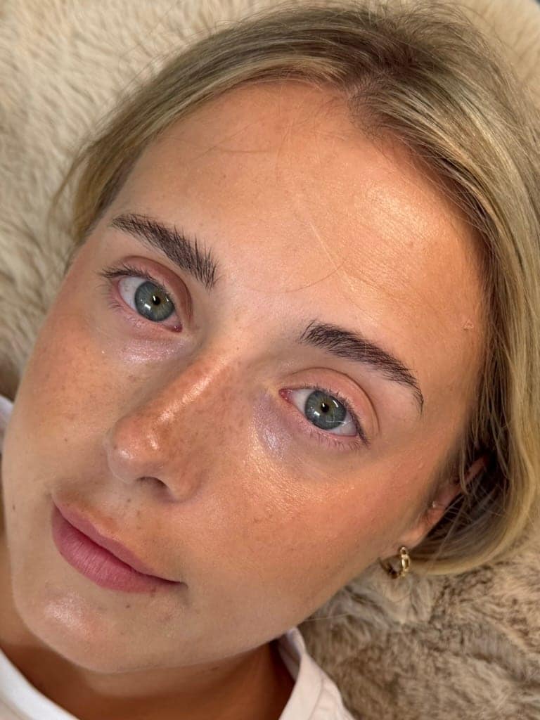 Before, Brow Lamination