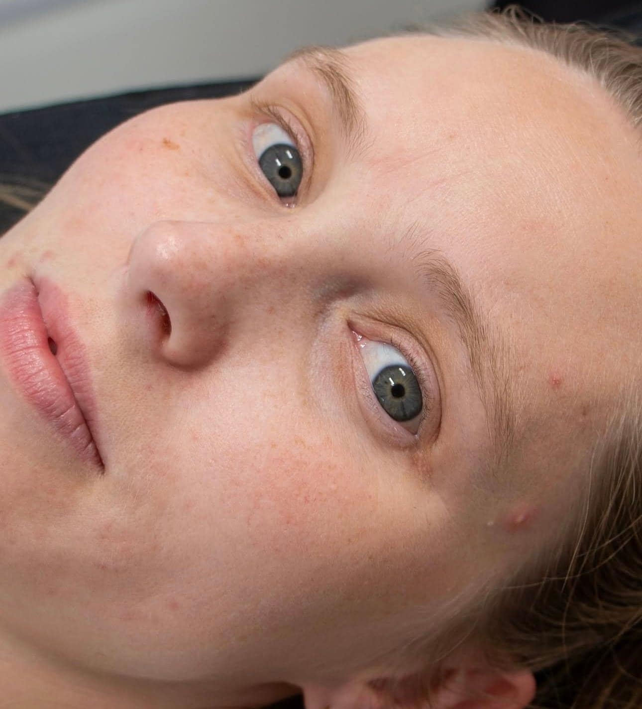 Before, Brow Lamination