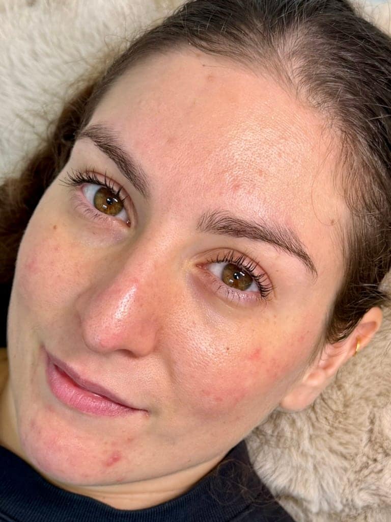 Before, Brow Lamination