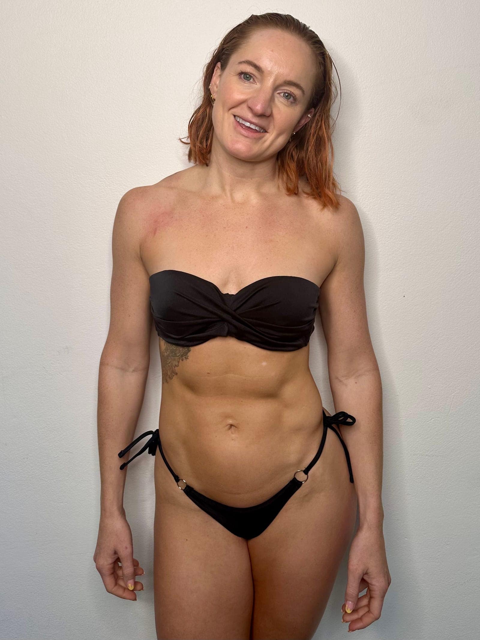 Before, The Bondi Glow Package